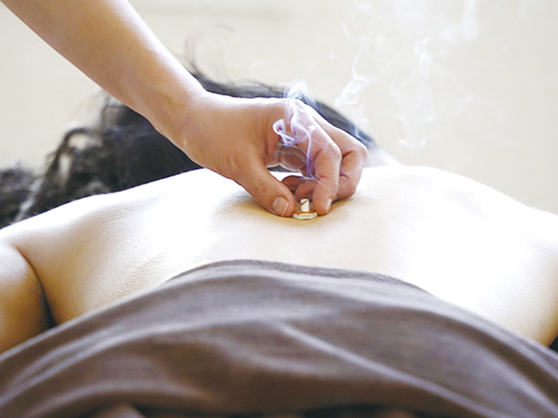 Nature のお灸施術の様子（背中に温灸を置いている写真）
